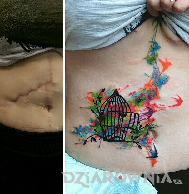 Blizna zakryta kolorowym tatuażem u dziewczyny