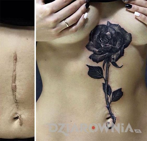 Blizna pokryta tatuażem róży na brzuchu kobiety