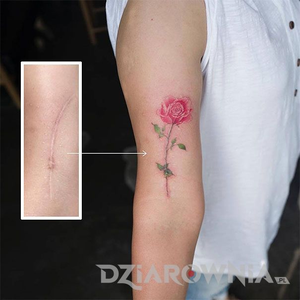 Blizna zakryta tatuażem różowej róży na ramieniu dziewczyny