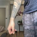 Nieudany tatuaż - Pozostał tylko blackwork?