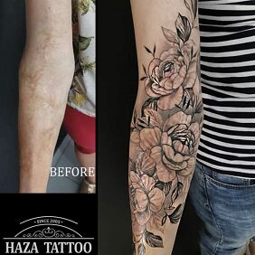 Tattoo Scar flowers cover up On the arm motif: cover-up style: realistic