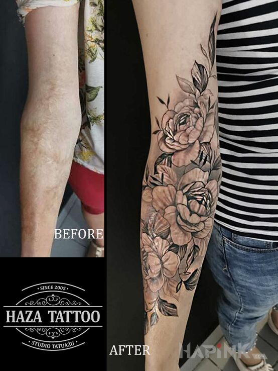 Tattoo Scar flowers cover up in cover-up motif and realistic style on the forearm