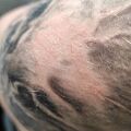 Pomoc - Wysypka/uczulenie/suchość skóry na i nad tatuazem