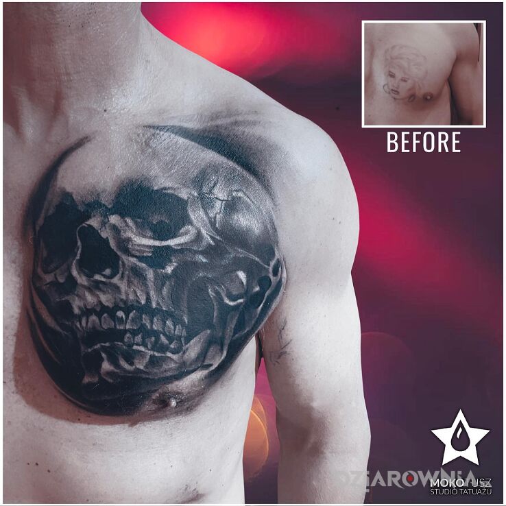 Tatuaż cover up czaszka w motywie czarno-szare i stylu realistyczne na klatce