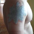 Pomoc - Pieczenie tatuażu na ramieniu