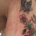 Pielęgnacja tatuażu - Problemy z gojeniem, proszę o poradę