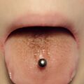 Piercing - Czarny nalot po piercingu języka