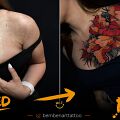 Pomysł na tatuaż - Tatuaż na bliźnie – czy można zakryć bliznę tatuażem?