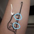 Pielęgnacja tatuażu - źle zagojony tatuaż?